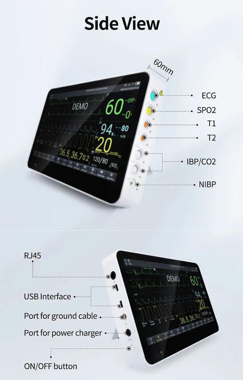 SEGUREPP - Monitor Multifuncional de signos vitales